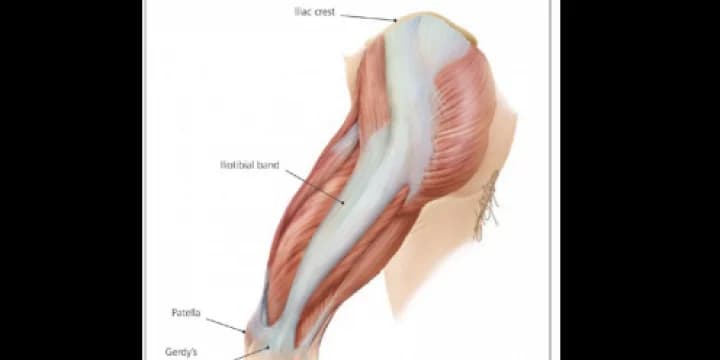 IT band tear in my sliding leg will mean a few weeks of no bowling for me