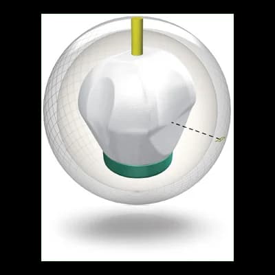 ball core